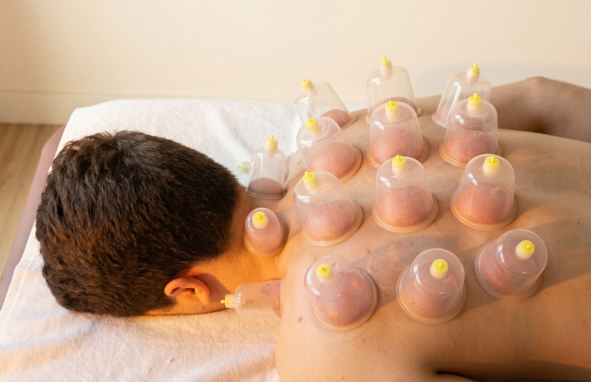 Vacuum (Cupping) Massage - photo 1